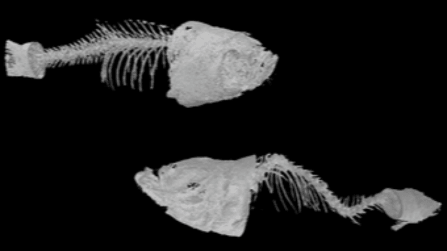 New perspective to understand and treat a rare calcification disease