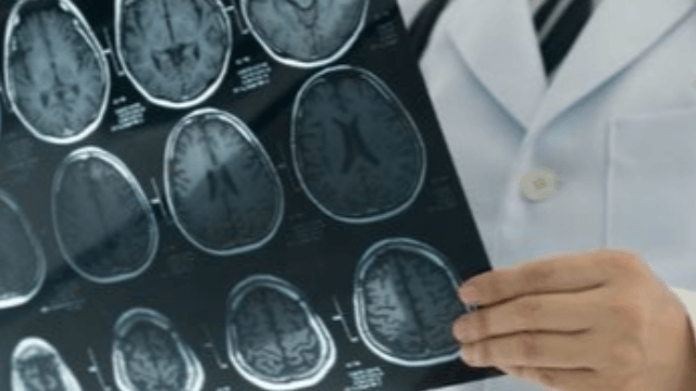 New dimensions in the treatment of muscle spasticity after stroke